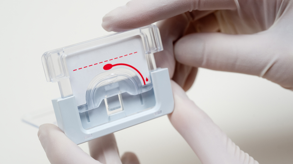 A single drop of blood is introduced into a transparent cassette, which includes all the reagents, fluid paths, and vacuum ports required for analysis.